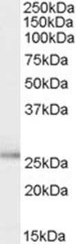 DDX19B Antibody