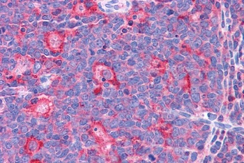 TPD52L2 Antibody