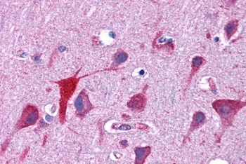 TPD52L2 Antibody