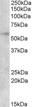 TPD52L2 Antibody