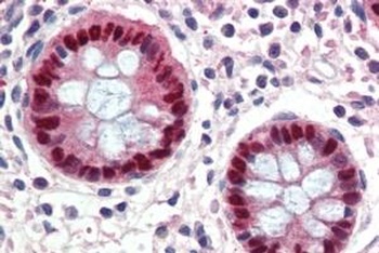 TPD52L2 Antibody