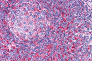 TPD52L1 Antibody