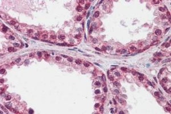 FOXP2 Antibody