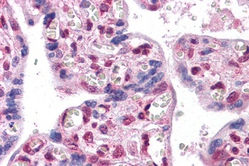 FOXP2 Antibody