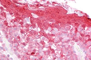 CSTB Antibody