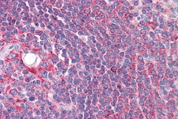 CYP26B1 Antibody