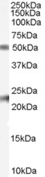 CYP26B1 Antibody