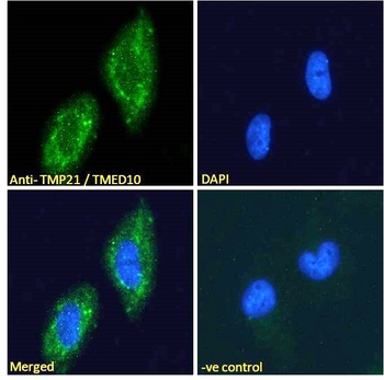 CYLD Antibody