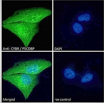CYBR Antibody