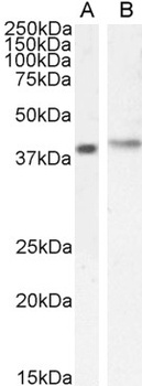 CYBR Antibody