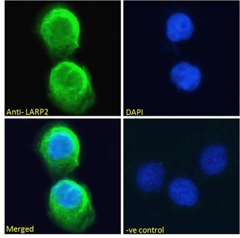 CXCR3 Antibody