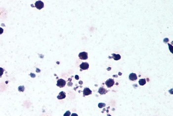 Cryopyrin Antibody