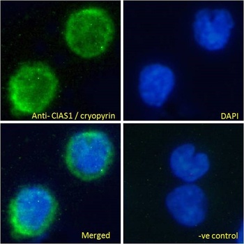 Cryopyrin Antibody