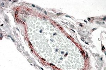 CRP2 Antibody