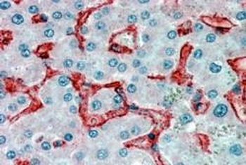 CRHR1 Antibody