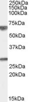 CRHR1 Antibody