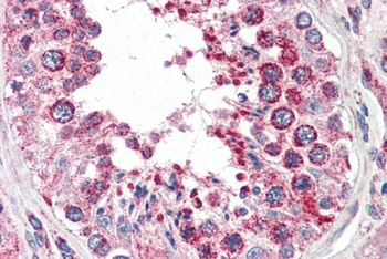 COX4I1 Antibody