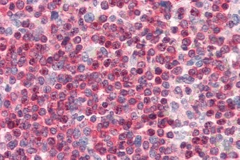 CORO1A Antibody
