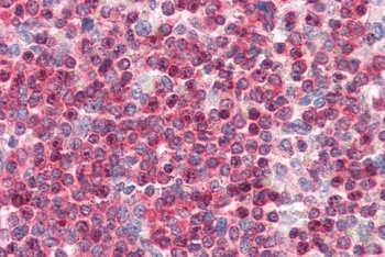 Coronin 1 Antibody