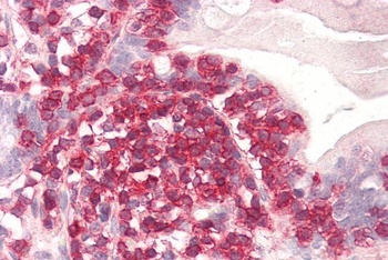 Coronin 1 Antibody