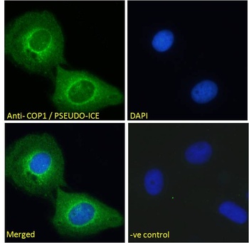 CARD16 Antibody