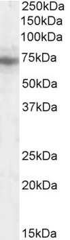 IFT74 Antibody