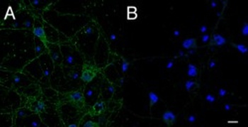 CMG1 Antibody