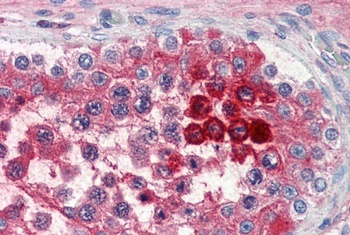 CLU Antibody