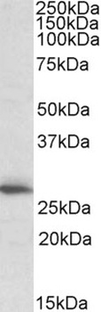 CLPP Antibody