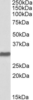 CILP Antibody