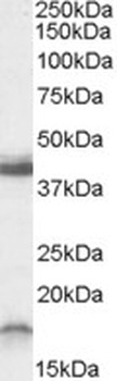 CHRNB3 Antibody