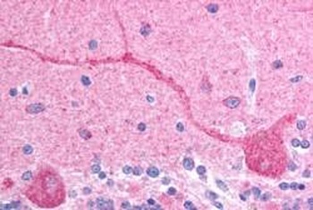 CHFR Antibody
