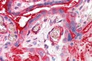 ADAP2 Antibody