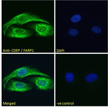 CDEP Antibody