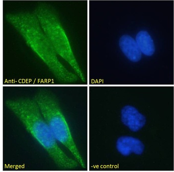 CDEP Antibody