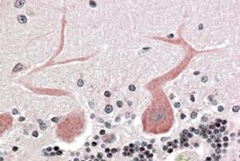 Cdc42-binding kinase alpha Antibody