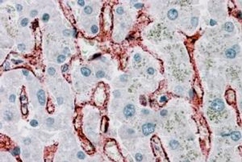 FCGR2B Antibody