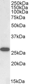 CD2BP2 Antibody