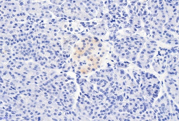 CCKBR Antibody