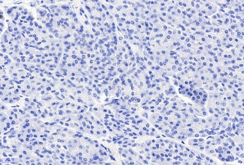 CCKBR Antibody