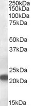 CBX5 Antibody