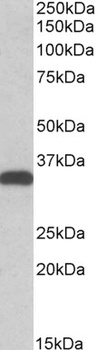 CBR3 Antibody