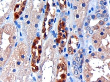 CBR1 Antibody