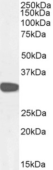 CBR1 Antibody