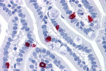 Cathepsin K Antibody