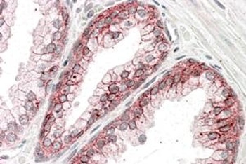 Catenin alpha 1 Antibody