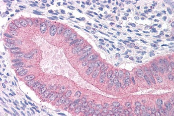 Catenin alpha 1 Antibody