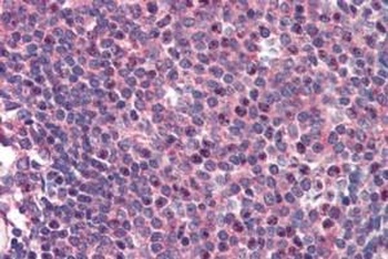CARD11 Antibody