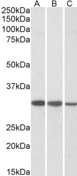 CAPZB Antibody