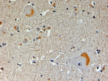 NOS1AP Antibody